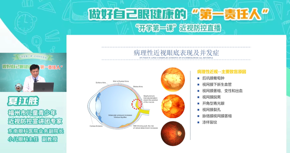 福州科技館眼健康分館開展做好自己眼健康的“第一責任人”開學第一課近視防控直播